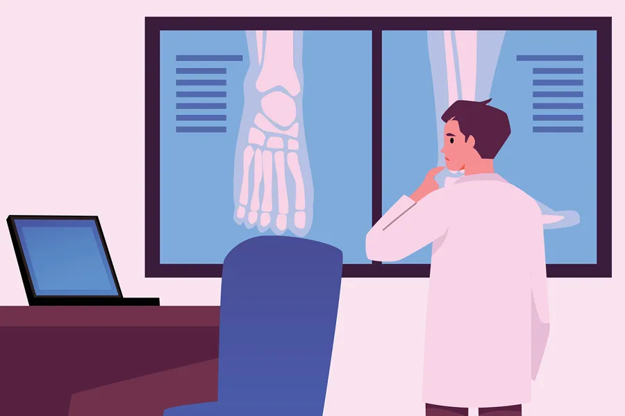 Illustrasjon av mann som ser på røntgenbilder