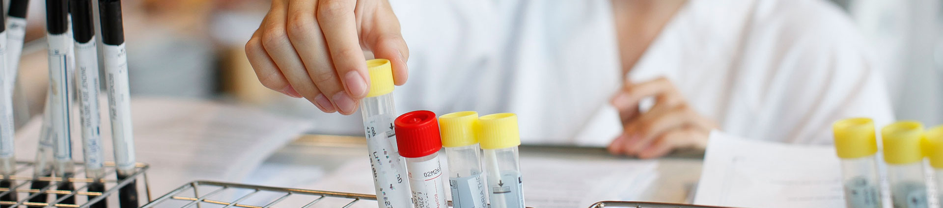 En person som holder et reagensrør