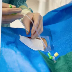 A person in a hospital bed