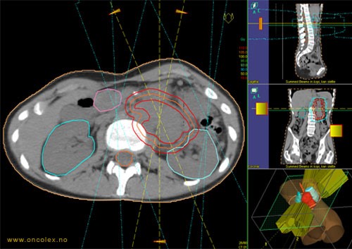 Røntgenbilde av hodet