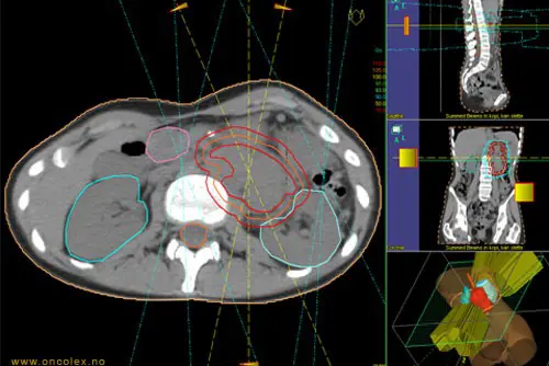 Røntgenbilde av hodet